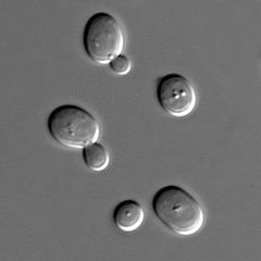 240px-S_cerevisiae_under_DIC_microscopy[1].jpg